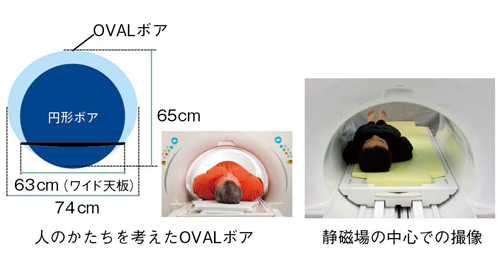 図2　OVAL Patient Bore