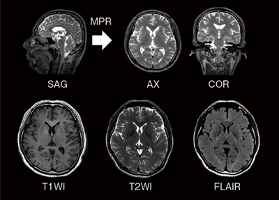 図4　Volume imaging 撮像機能“isoFSE”