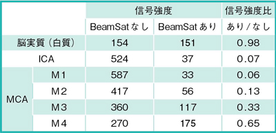 表1　ICA～MCA-M4の信号強度（健常例）