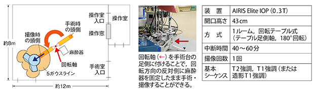 イメージガイド脳神経手術室のレイアウト（MRI，麻酔器以外の設備・機器は省略）