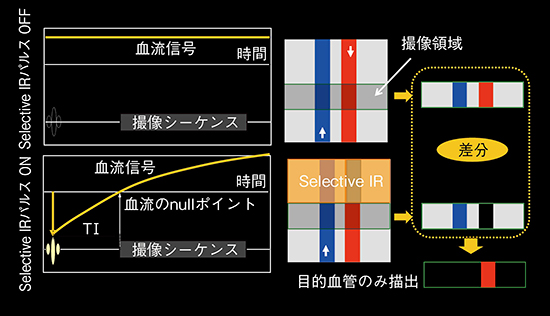 図1　差分法におけるVASC-ASLの概念