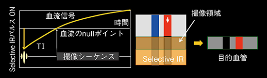 図2　非差分法におけるVASC-ASLの概念