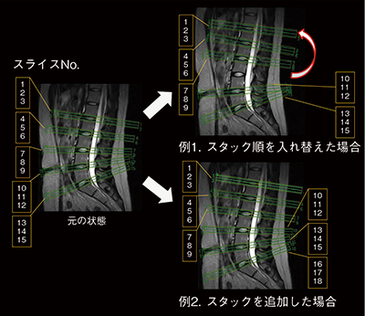 図5　スライスNo.の自動修正