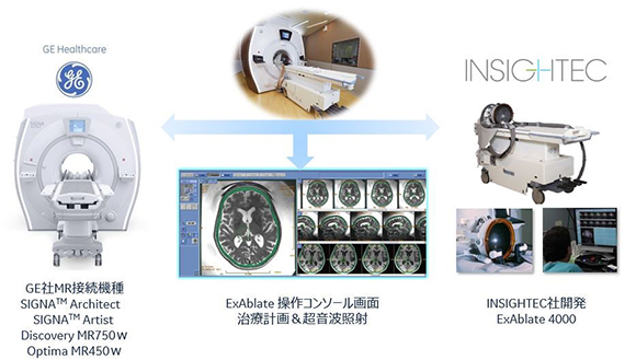 MRガイド下集束超音波治療器　ExAblate 4000