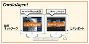 図4　CardioAgentは，米国Heartlab社（現Agfa社）の高速動画ネットワークと，ソフトクオリティ社の臨床技術の高いレポートの組合せである。