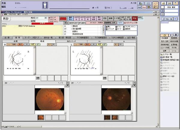 眼科カルテ眼底所見画面