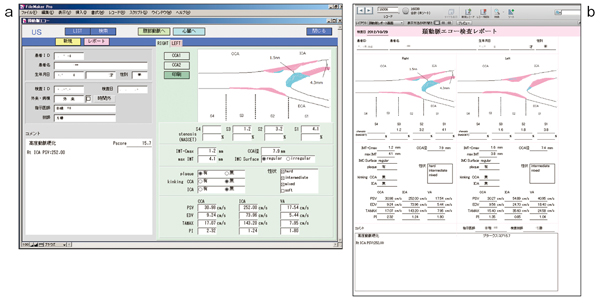頸動脈エコー検査システム a：入力，b：レポート
