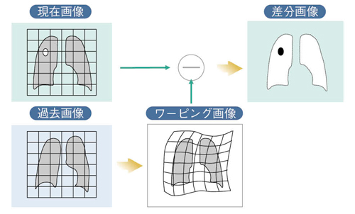 図2　経時差分アルゴリズム