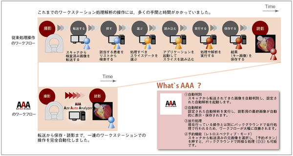 AZE Auto Analyzerのワークフロー