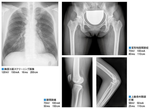 DigitalDiagnostによる臨床画像