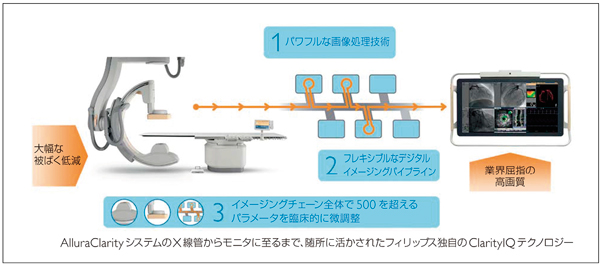 図1　AlluraClarityシステムのX線管からモニタまで，随所に生かされたフィリップス独自のClarityIQテクノロジー