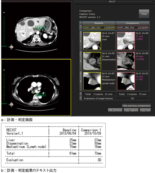 図5　RECIST計測ツール