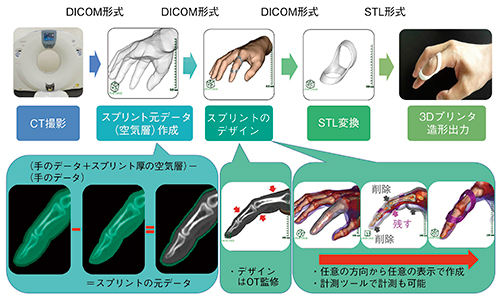 図4　リングスプリントの試作の作成工程