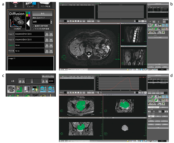 図1　cDWI解析の画面構成