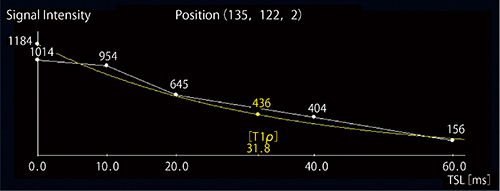図5　VirtualPlaceによるT1ρ緩和グラフ