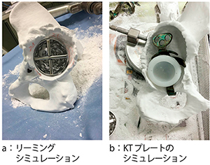 図4　人工股関節シミュレーション