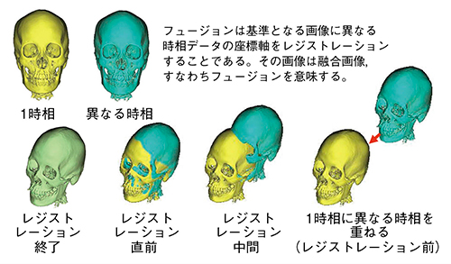 図2　剛体処理によるフュージョン画像作成