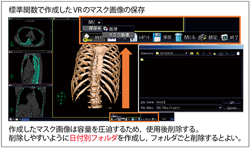 図3　マスク画像データの保存