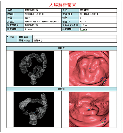 図7　大腸解析レポート（結果）