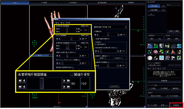 図3　新・CT細血管解析の詳細設定