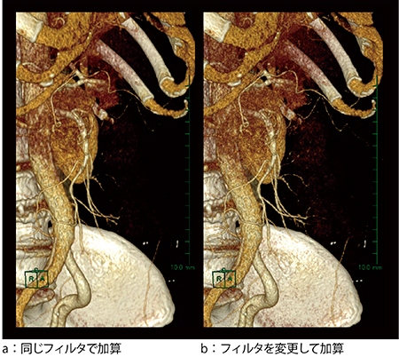 図6　解析例(3)：画像再構成条件を変更した加算処理