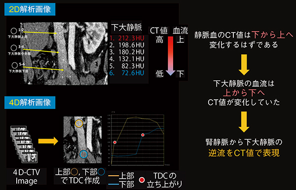 図3　CT値を用いた血流評価