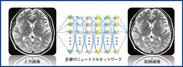 図1　DLRの概念（W.I.P.）