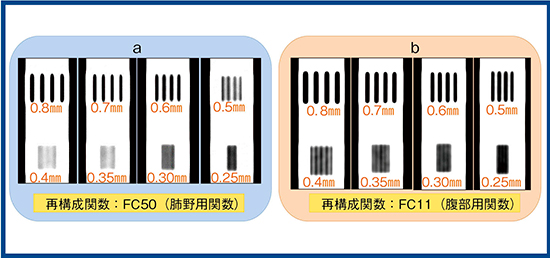 図8　10％TTFでのMDCT（a）とAquilion Precision（b）の比較