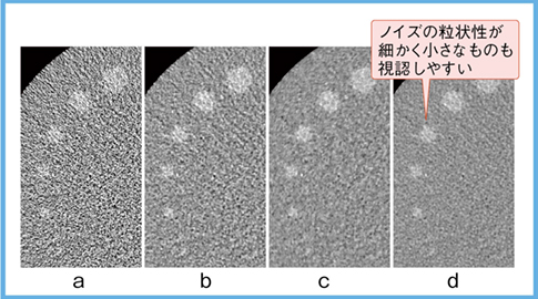 図5　低コントラスト・低線量のファントム画像 a：FBP（FC13）　b：Hybrid IR（FC13） c：MBIR（Body）　d：DLR（Body）