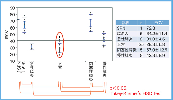 図5　各種膵疾患のECV