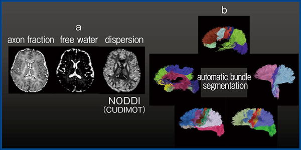 図2　ポピュラーな拡散MRI解析手法 （図1と同一データを使用） a：NODDI2），3） b：拡散トラクトグラフィによる白質セグメンテーション4）