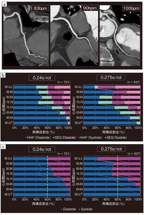 図1　高心拍症例の冠動脈CT画像と画像再構成における最適位相 a：冠動脈CPR画像（ハーフ再構成）　b：心拍数と画像再構成における最適位相の相関　c：bを拡張期と収縮期で色分けしたグラフ