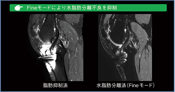 図1　Fineモードによる水脂肪分離不良の抑制