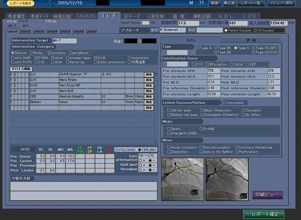 図1　CardioAgent proレポートシステム（ソフトクオリティ/東芝メディカルシステムズ）