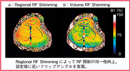 図1　DAM法で計測されたB1 mapの比較