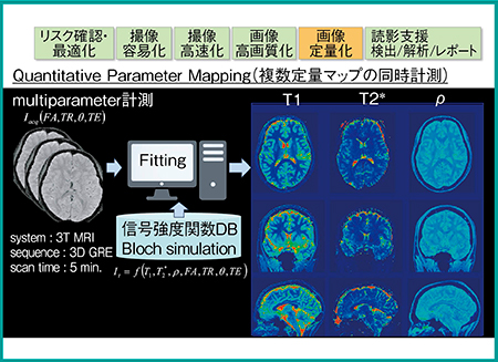 図4　定量マッピングによる画像の定量化4）