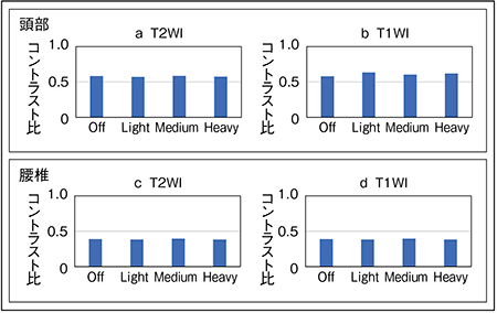 図4　IP-Reconの強度によるコントラスト比測定結果