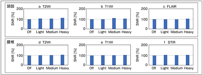 図7　IP-Reconを空間分解能向上に活用した画像のSNR変化