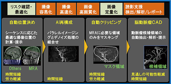 図2　統合環境における脳動脈瘤検出フロー