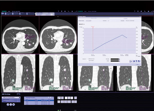 図6　MM Oncology 多発性肺転移病変の評価