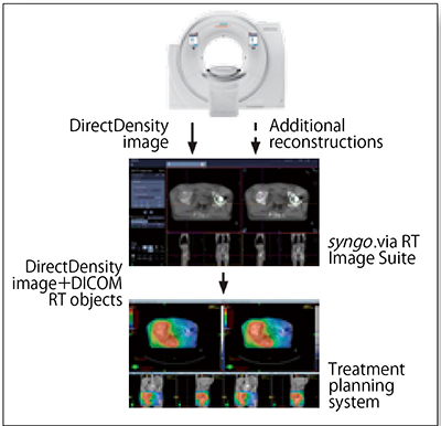 図5　DirectDensityを用いた線量分布計算までの流れ （画像提供：シーメンスヘルスケア株式会社）
