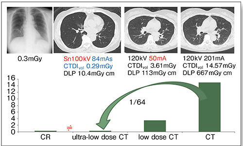 図7　当院の胸部CT撮影における被ばく線量の変遷