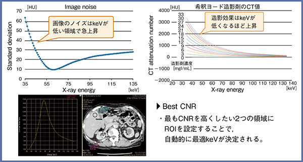 図3　自動的に最適なkeV画像を決定：Best CNR