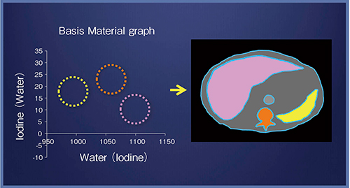 図4　Basis Material解析結果の再構成画像への反映