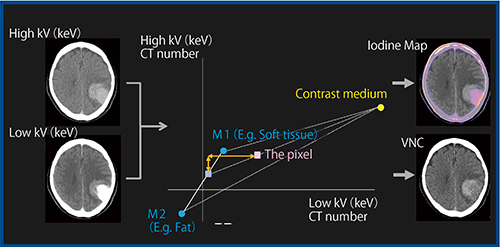 図4　Material Decomposition解析