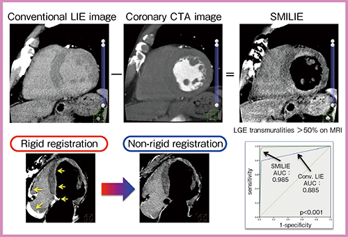 図4　SMILIEによる心筋バイアビリティ評価 （RSNA 2015で発表）