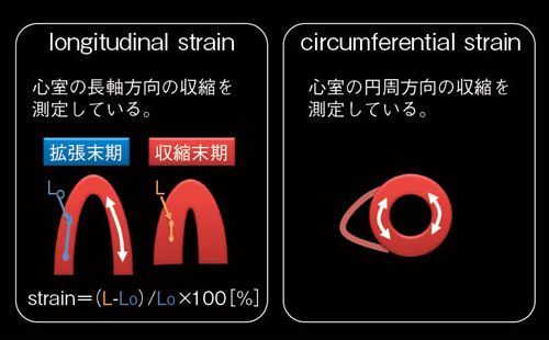 図1　心筋のストレインについて（参考文献：Oyama-Manabe, et al. Eur Radiol 2011;21(11):2362-8）