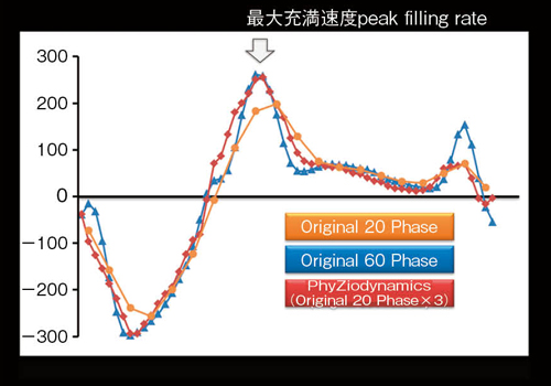 図6　左室容量曲線から求めた微分曲線（参考文献：Journal of Cardiovascular Magnetic Resonance 2009, 11: 30 2008,10：36）