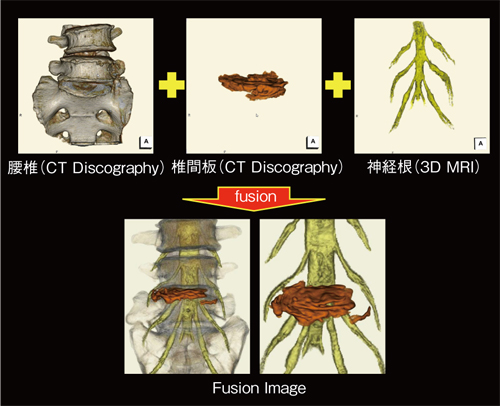 図2　Fusion Image