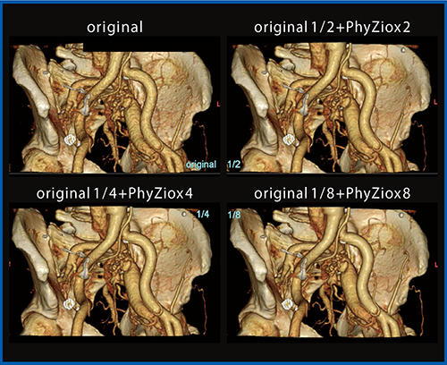 図4　PhyZiodynamicsの補完処理による4Dイメージの比較 元画像を間引いたデータをPhyZiodynamicsで同じフェーズ数に補完した。